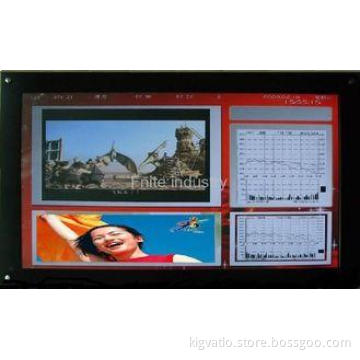 Video / Picture Network Digital Signage Media Player , 1080